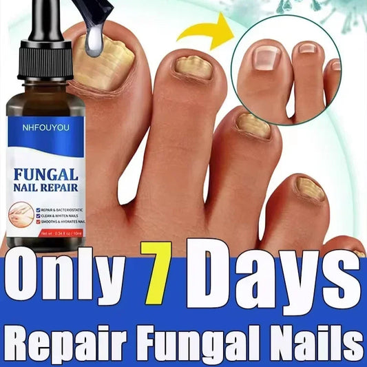 Toenail Repair Fungus Treatment Oil